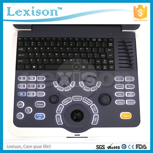 
Cardiac Portable Ultrasound 4D Ultrasound Scanner Color Doppler Ultrasound Machine Price 