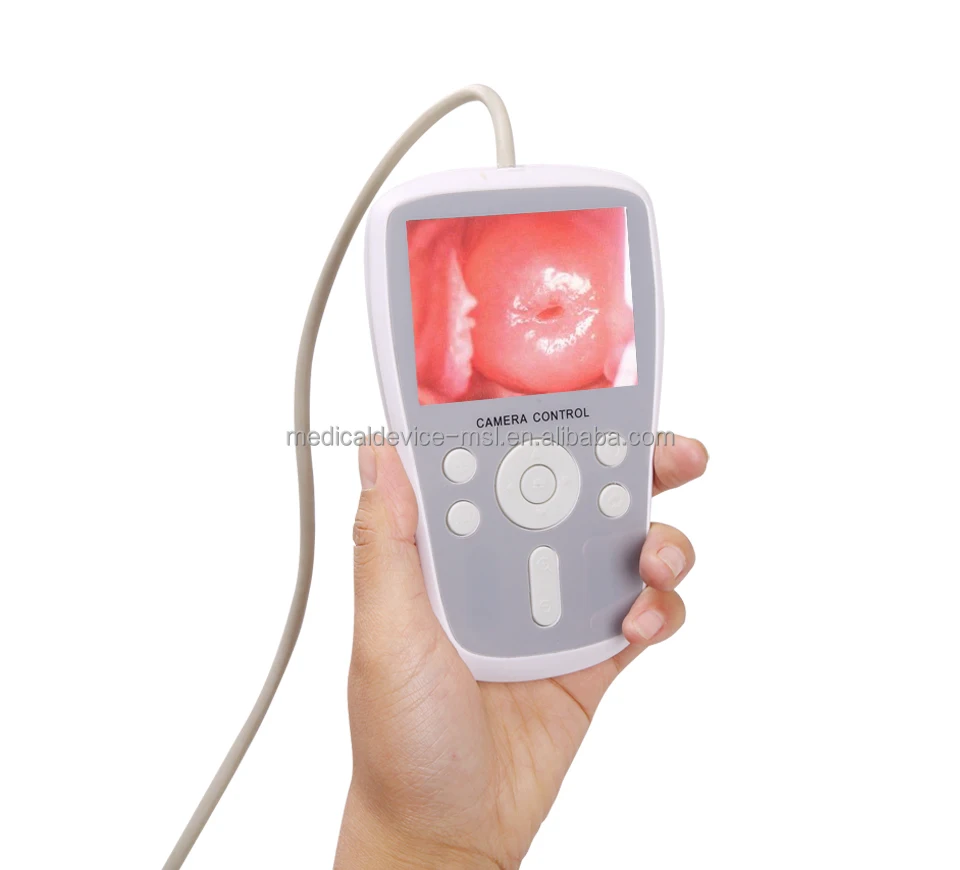 
China Best Price for Handheld Portable Color Digital Video Colposcope for vulva, vagina and cervix diagnostic - MSLCE04 
