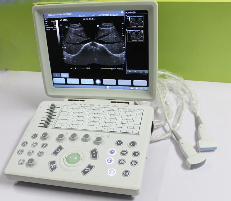 MSLPU33  portable cheap B/W ultrasound machine/ultrasound scanner for clinic
