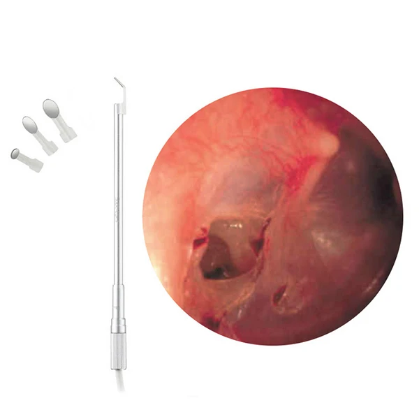 
 2018 портативные Эндоскопы с эндоскопом, китайский поставщик, Эндоскопы с эндоскопом на Android, трендовые гибкие Эндоскопы 2018 года  