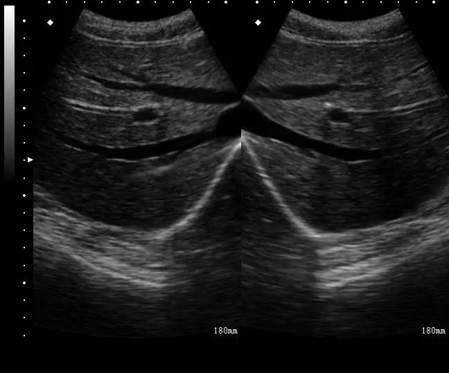 FY-UP-10 IPAD Tablet Mini Ultrasound Scanner