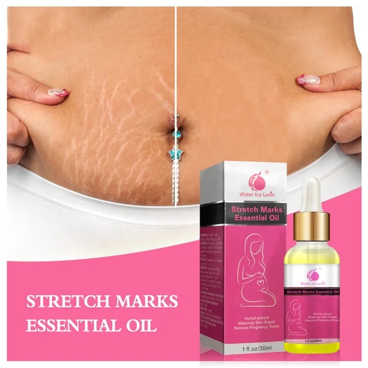 Water Ice Levin brand Herbal extract maternity skin repair remove Pregnancy Stretch Marks Scars Essential oil