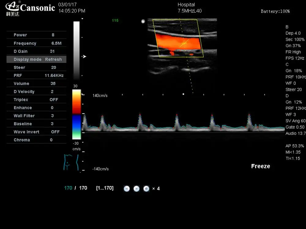 Manufacture price 4d portable color doppler ultrasound