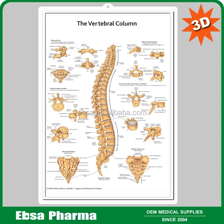 Educational Plastic 3D Medical Anatomical Wall Chart - Understanding Arthritis