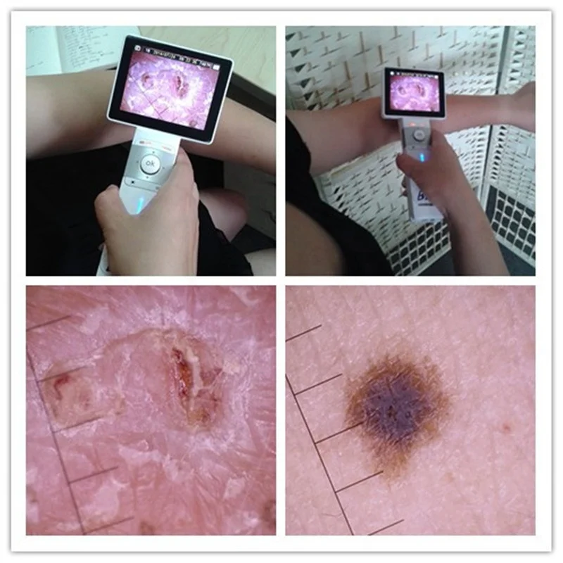 Digital ENT Otoscope Video Throat Camera Dermatoscope Endoscope With Great Price
