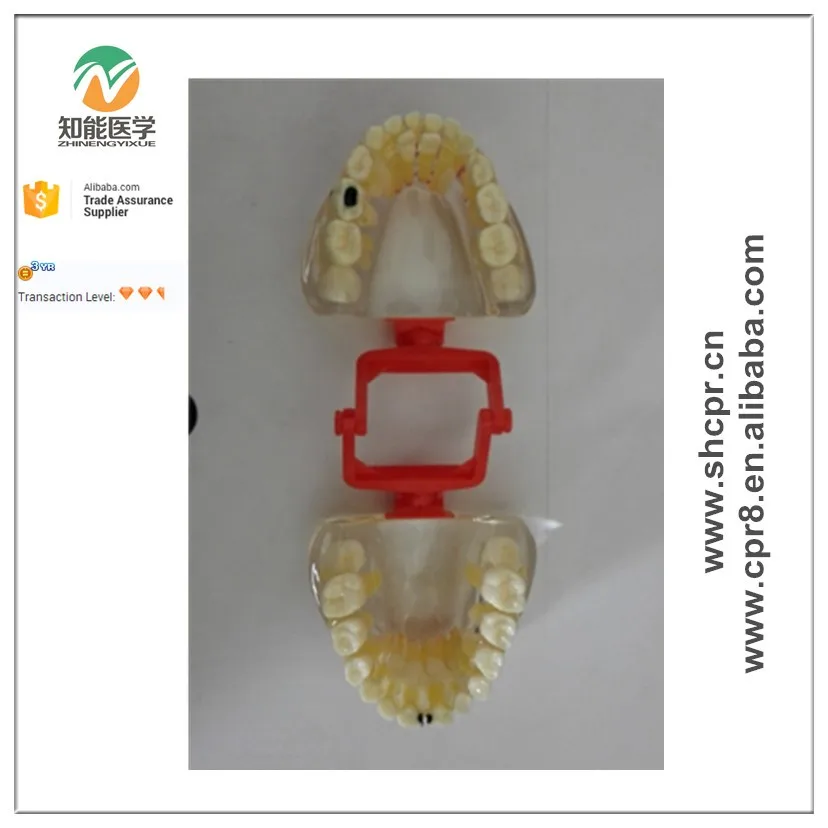 BIX-L1006 Transparent baby teeth pathological dental model