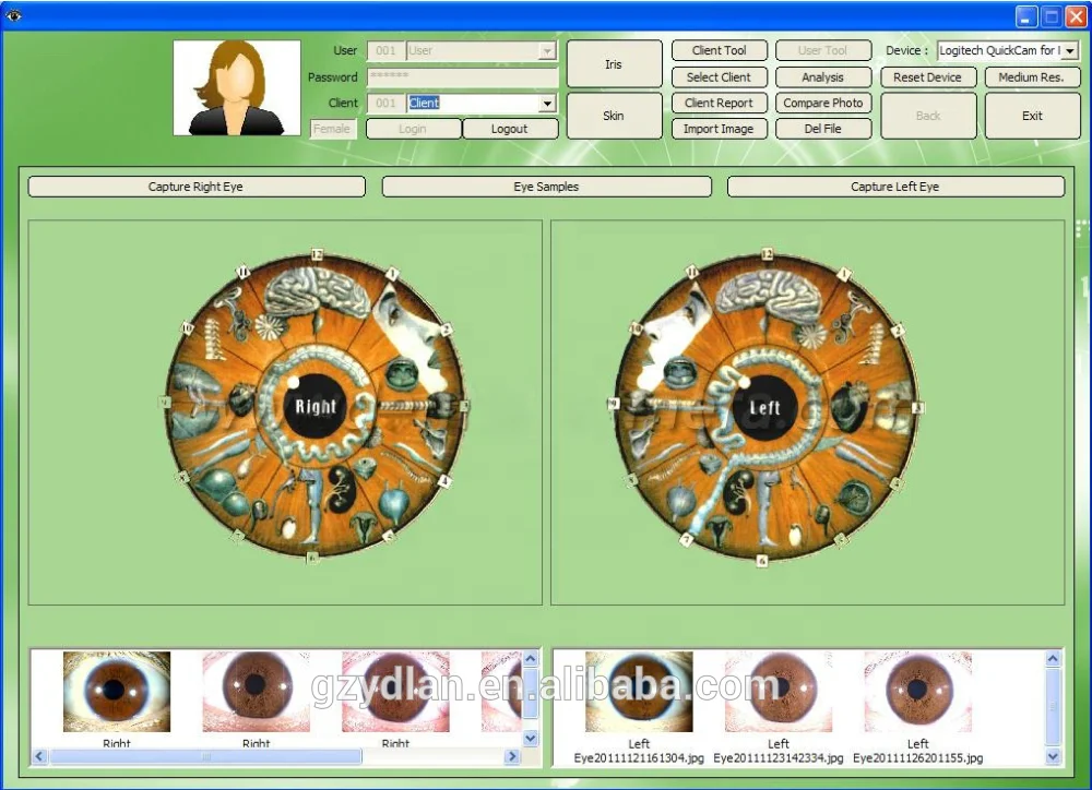 NEW 5.0 MP 4 LED/2 LED USB PRO software iris analyzer machine