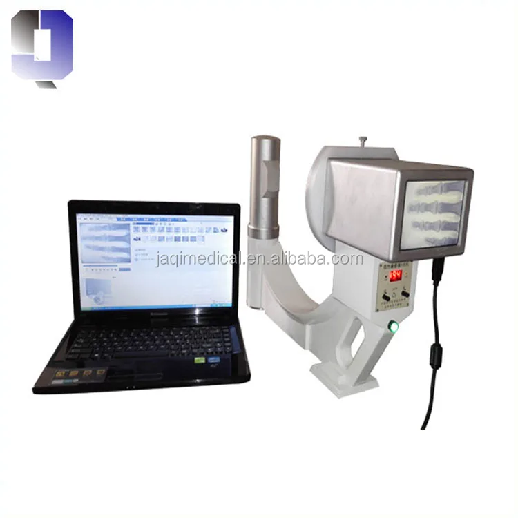JQ-75Y  Mini X-ray machine can realize image and video collection on computer directly