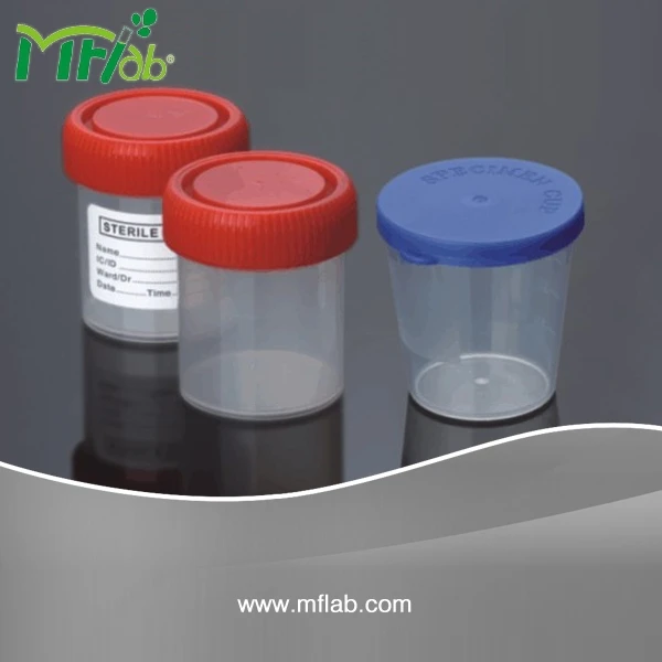 Laboratory Disposable PP Graduated  Specimen Container for Urine collector sampling test with Label (40ml, 60ml)