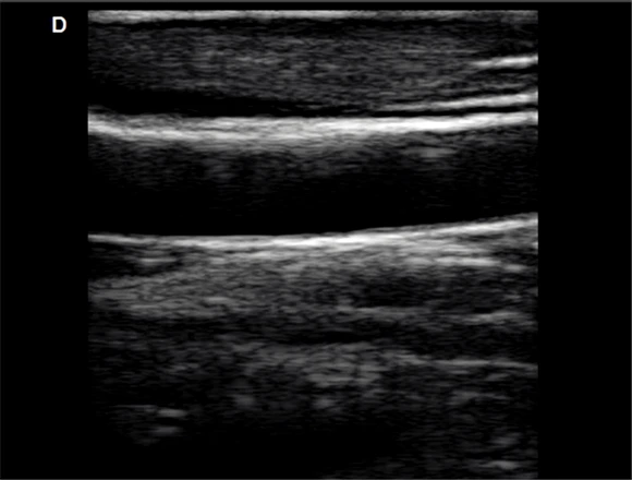 portable vascular doppler & color ultrasound doppler system DW-L3