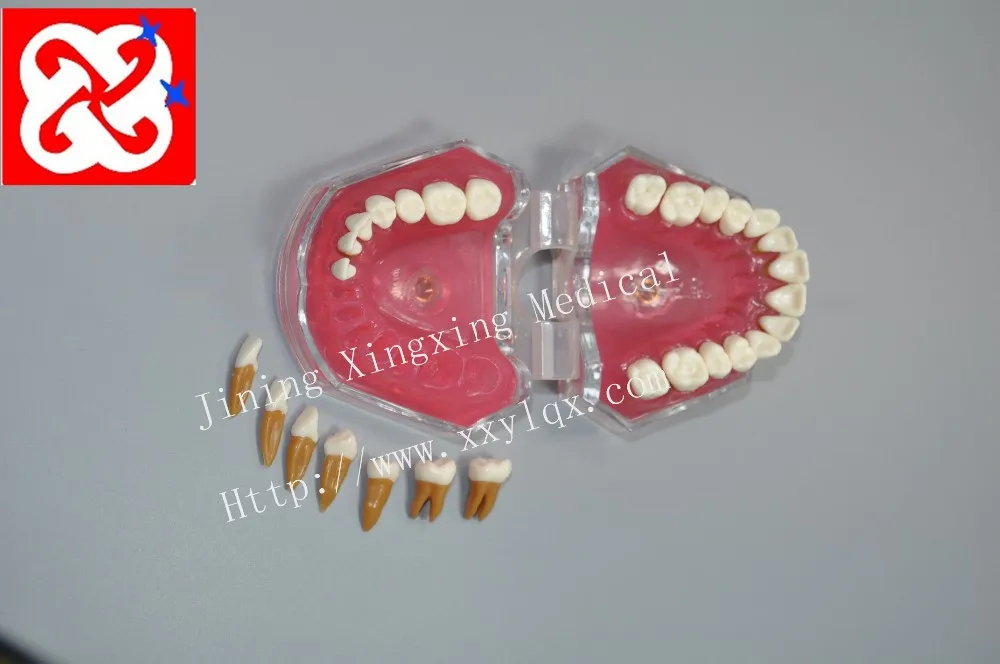 Extractable teeth model demonstrate tooth structure anatomy practice model with soft silicone gum adult