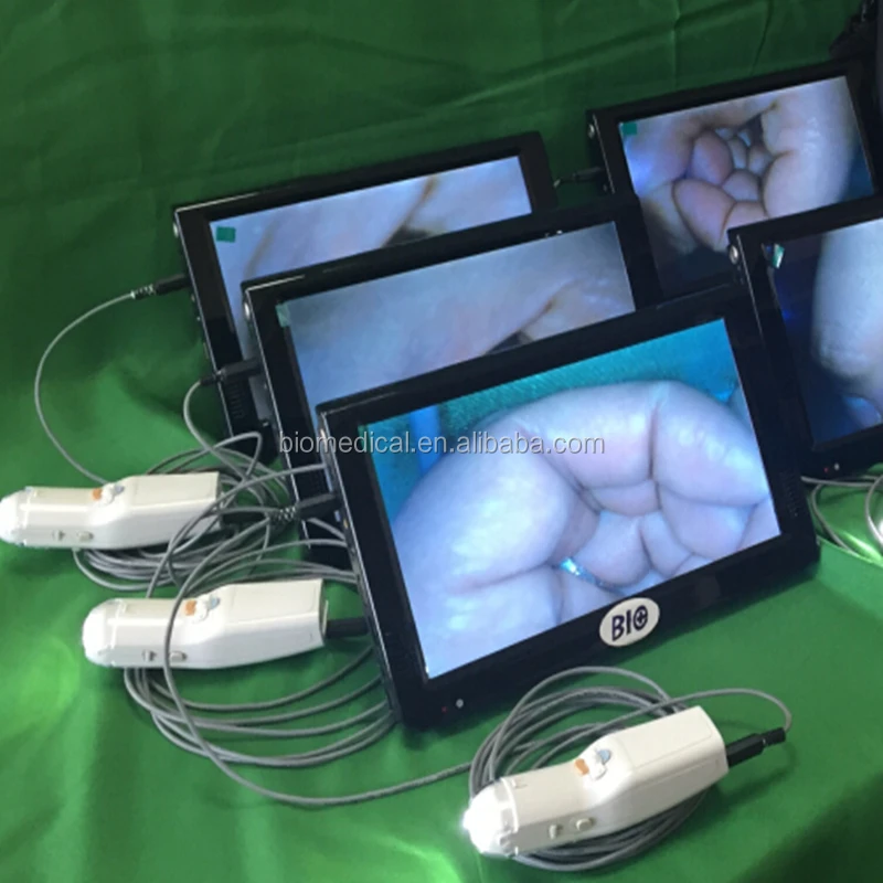 Vagina Endoscopy Colposcope Vaginal Camera Scope With Optional Screen