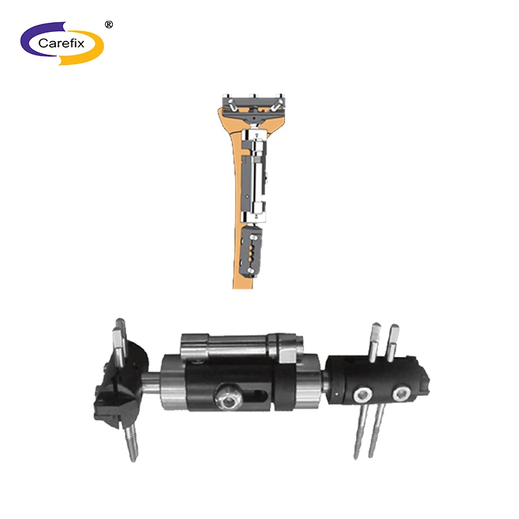 Eco-friendly ankle joint External Fixation Device for Femur
