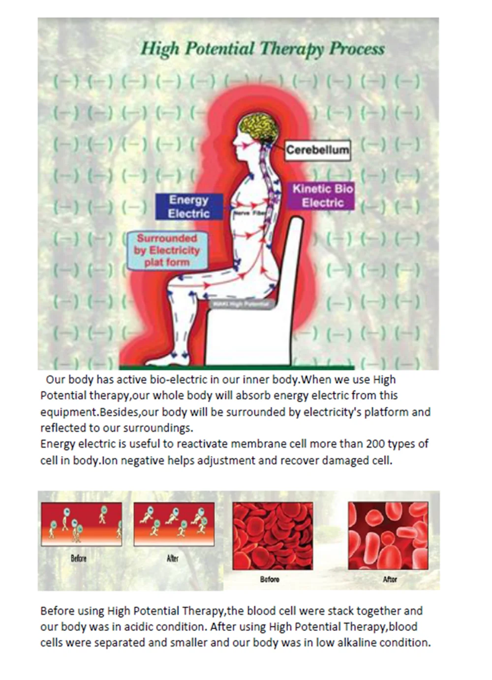 Medical Physiotherapy Negative Ion High Potential Therapy Device