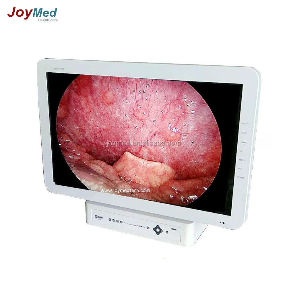 all in one medical 1080P endoscope camera light source with screen
