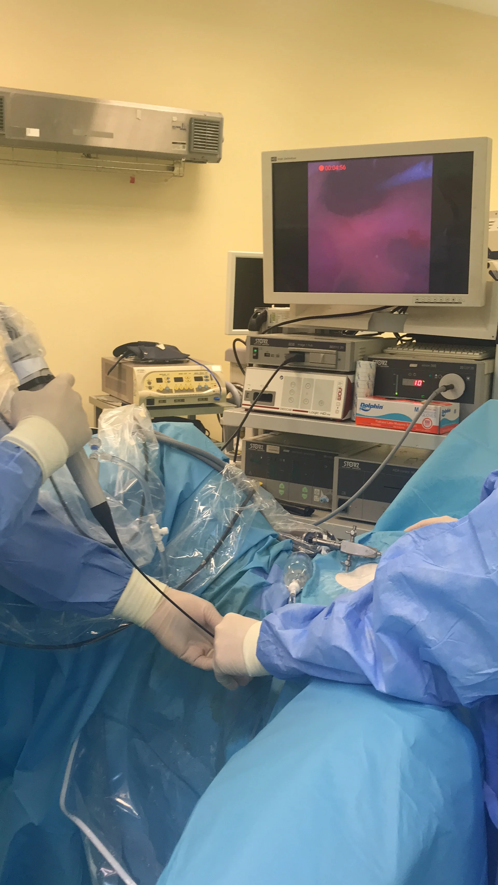 Full HD portable ENT video endoscope/endoscope video camera