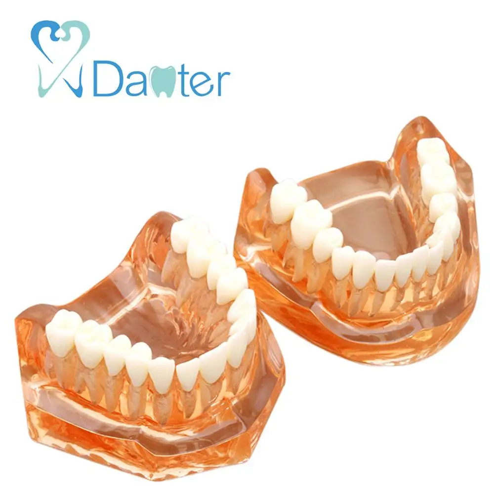 Fantastic Quality Dental Model, Soft Gum with Removable Teeth without Hinge