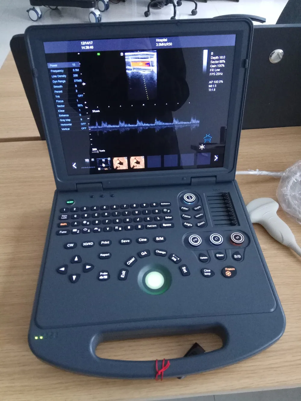 hot selling 2021 style Design latest cardio color doppler & portable doppler ultrasound machine with certificate