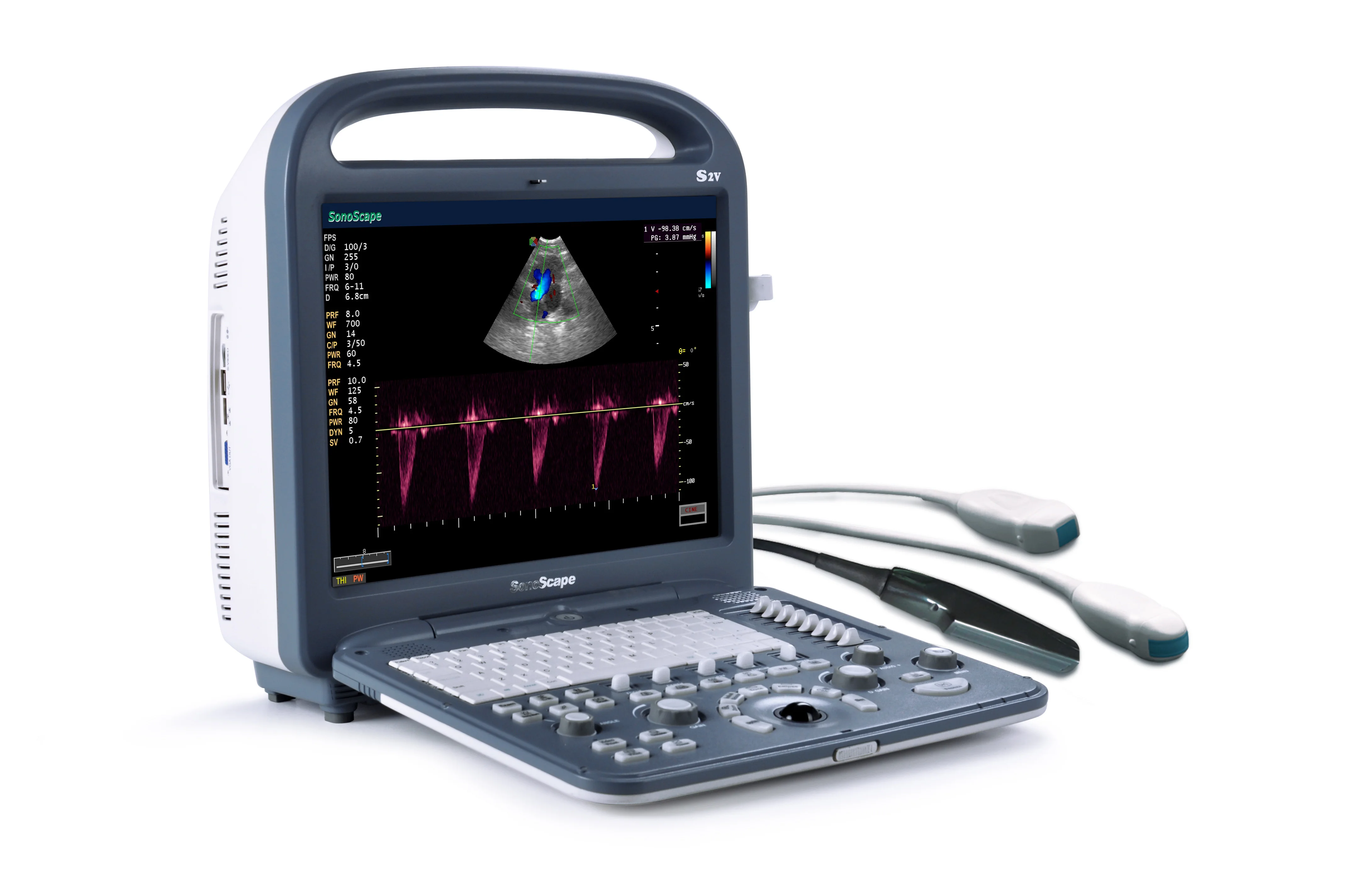 Famous color doppler ultrasound machine sonoscape p20 price