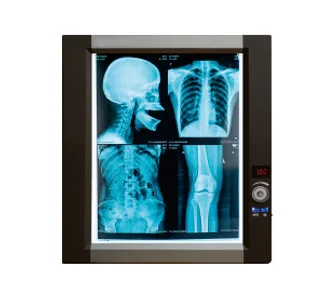 Mplent ultra slim x ray film digitizer led lights radiograph viewer
