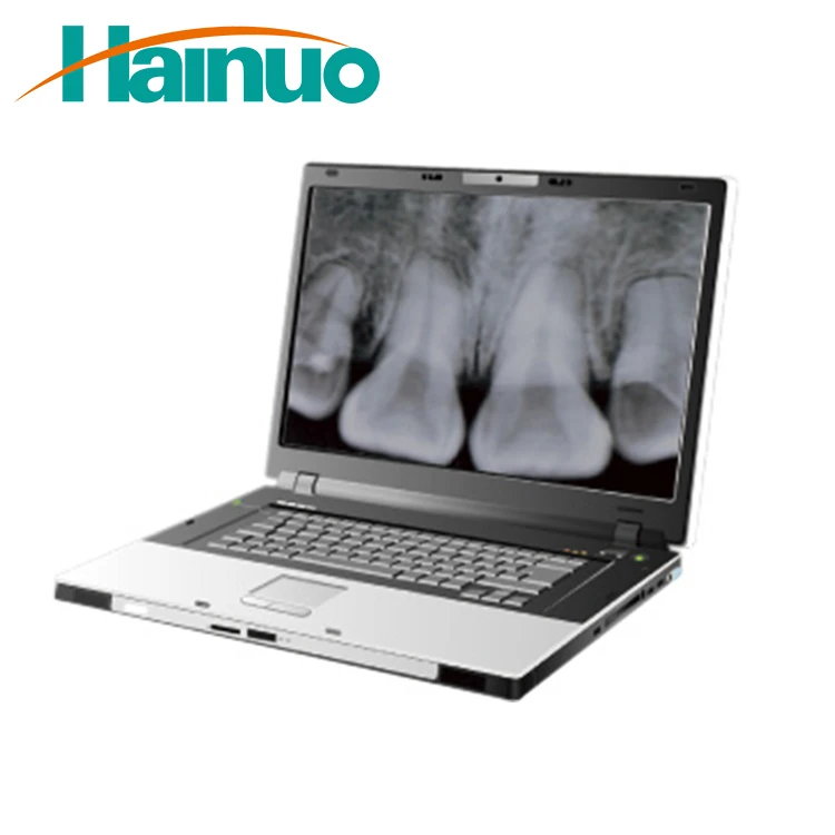 F100 Intraoral Digital Dental Panoramic Wireless X-Ray Senso Machine