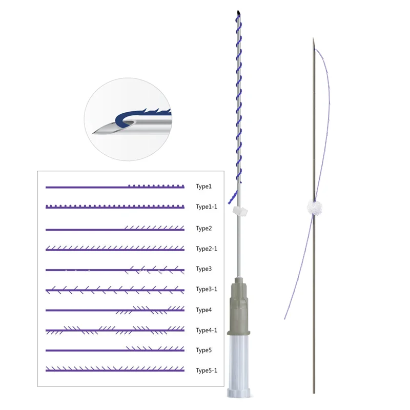 Cosmetic facelift types of cannula hilos tensores para el rostro