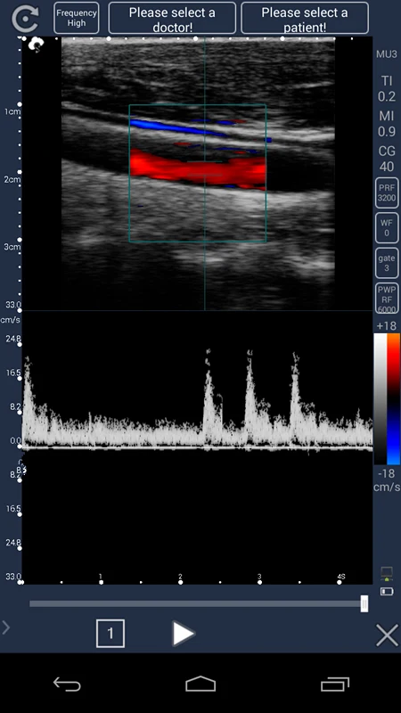 TOP-A1025 portable 4d color doppler ultrasound scanner system usb