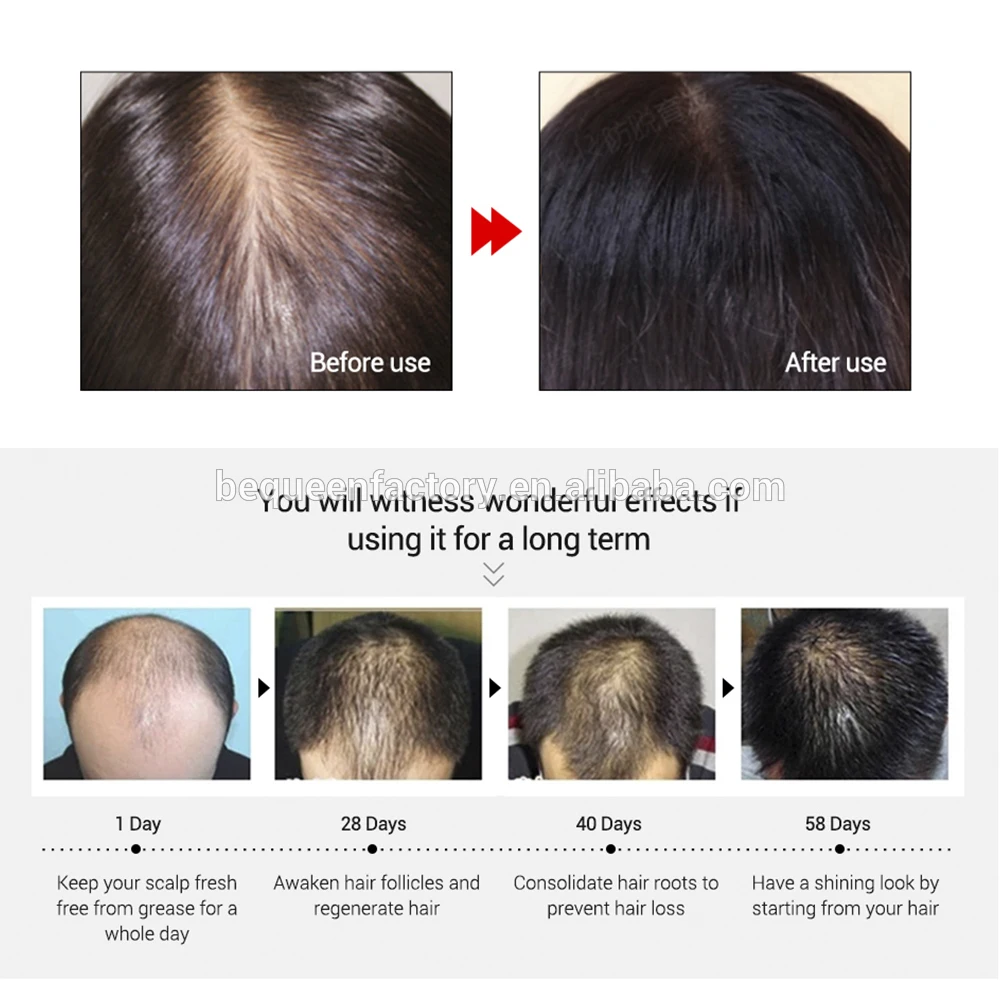 Chinese Trending Hair Care Product YUDA Effective Hair Loss Treatment For Hair Growth
