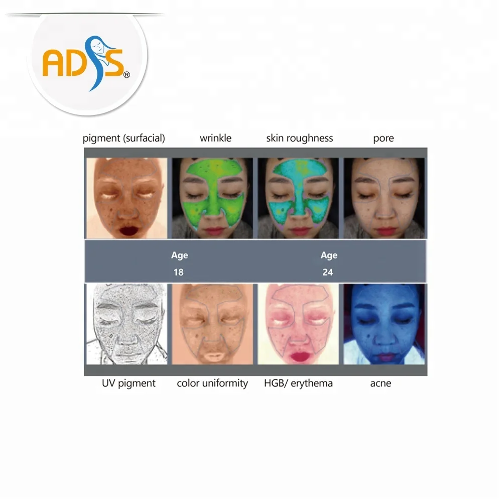 ADSS Новый Профессиональный 4D анализатор кожи лица диагностическая система машина для анализа