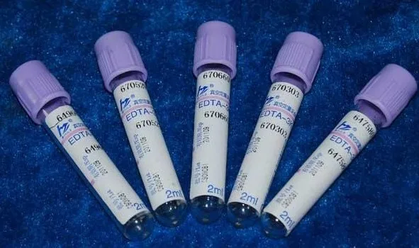 4 мл EDTA вакуумная трубка для определения крови
