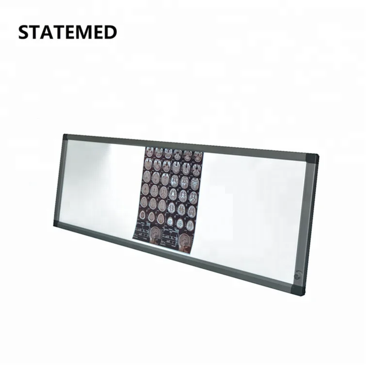 , Customized X-ray Film Viewer Box Medical View Box Led Negatoscope Medical X-ray Equipments & Accessories Class I 12kg 1424*425