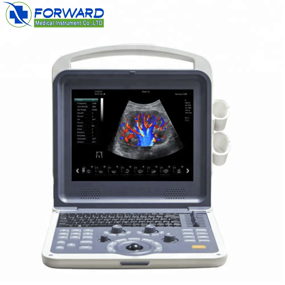 3D&4D ultrasound scan imaging function /china portable ultrasound machine price