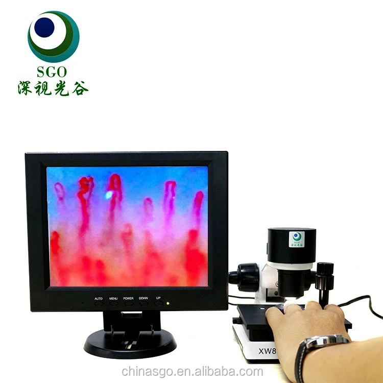 Microcirculation detecting instrument health instrument
