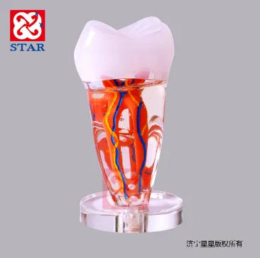 Big cartoon molar with transparent wax model demonstrate the  nerve for dental decoration and study