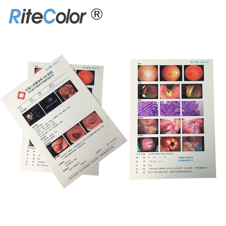 A4 210micron White Inkjet Digital PET Medical Film for Canon Epson Printer