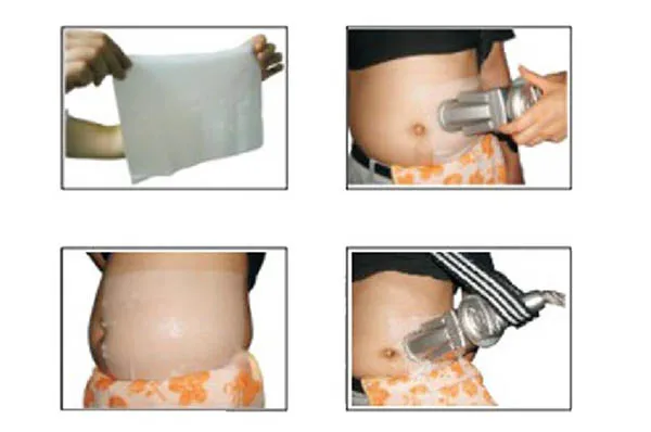 Настольный Нехирургический машина Cryolipolysis Замораживание жир Уменьшение целлюлита Fast