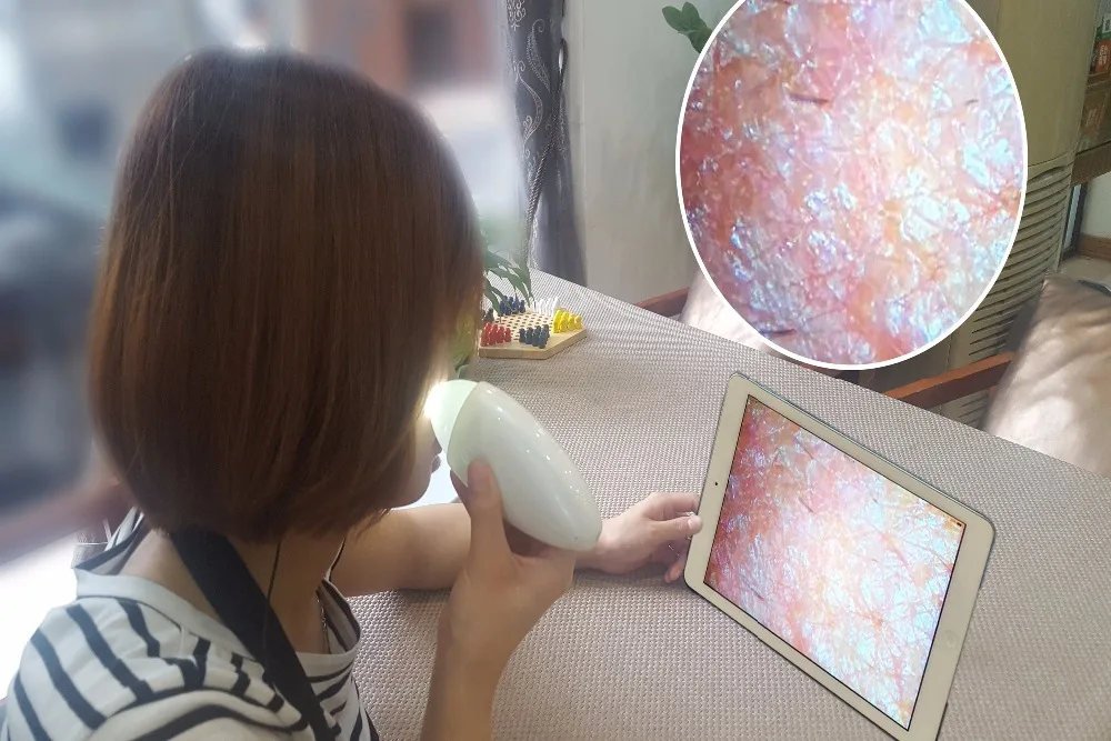 Portable wifi skin scanner can detect skin moisture pigment oil wifi scalp camera hair analyzer HD skin camera