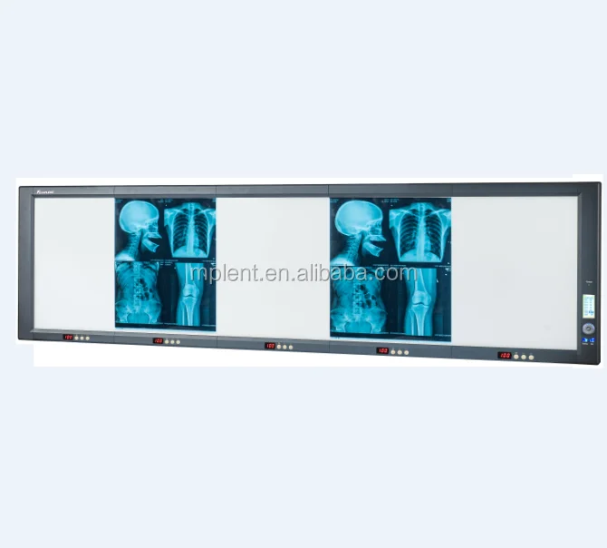 
Best quality medical LED film viewer multi-panel Ultra brightness x ray LED negatoscope cheap View Lamps led view box 