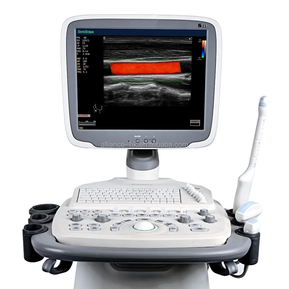 Sonoscape S11 Trolley Color Doppler UltrasoundUSG Gynecology Urology MSK 15 inch Display