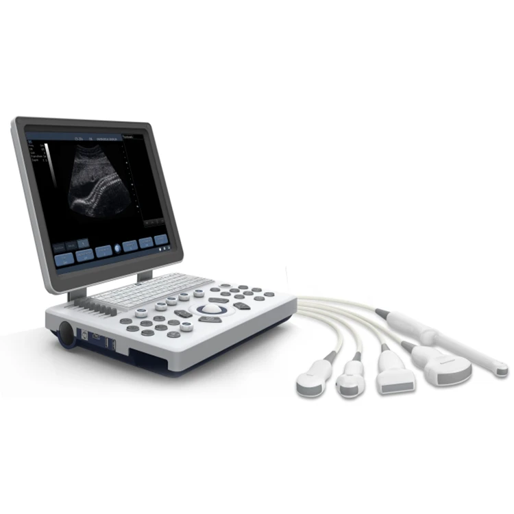 MSLPU33  portable cheap B/W ultrasound machine/ultrasound scanner for clinic