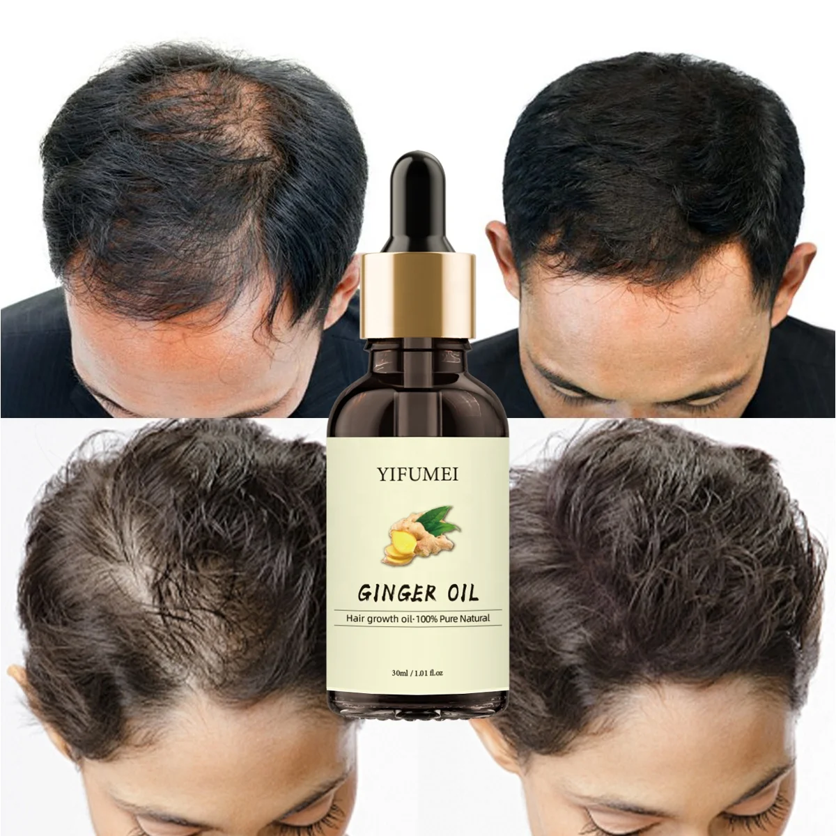 4 In 1 Ginger Ginseng Rosemary Argan Oil Scalp Care Hair Loss Regrowth Growth Oil Serum Bald Treatment For Men Women Ladies
