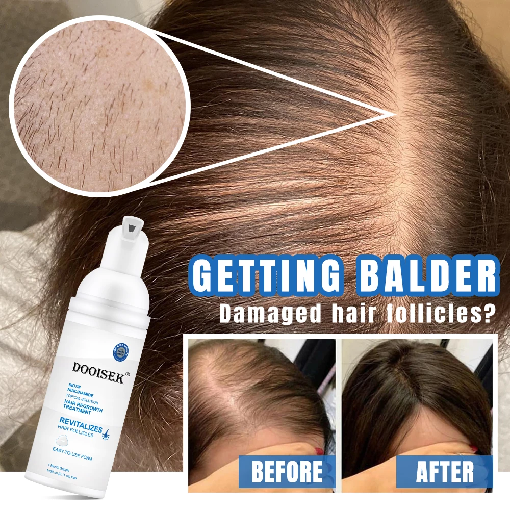 Hot selling OEM ODM 60ML Hair Regrowth Foam Hair Growth product Anti-Loss Custom Hair Growth Oil