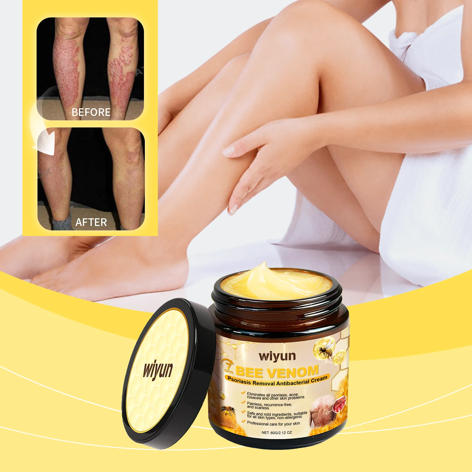 Bee Venom Psoriasis Antibacterial Cream Effective Skin Cream Gentle Original Skin Cream