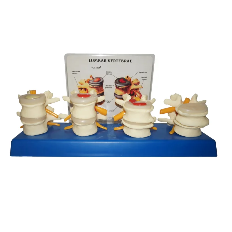 Модель каркаса R020704 для медицинской анатомии позвоночника, поясницы