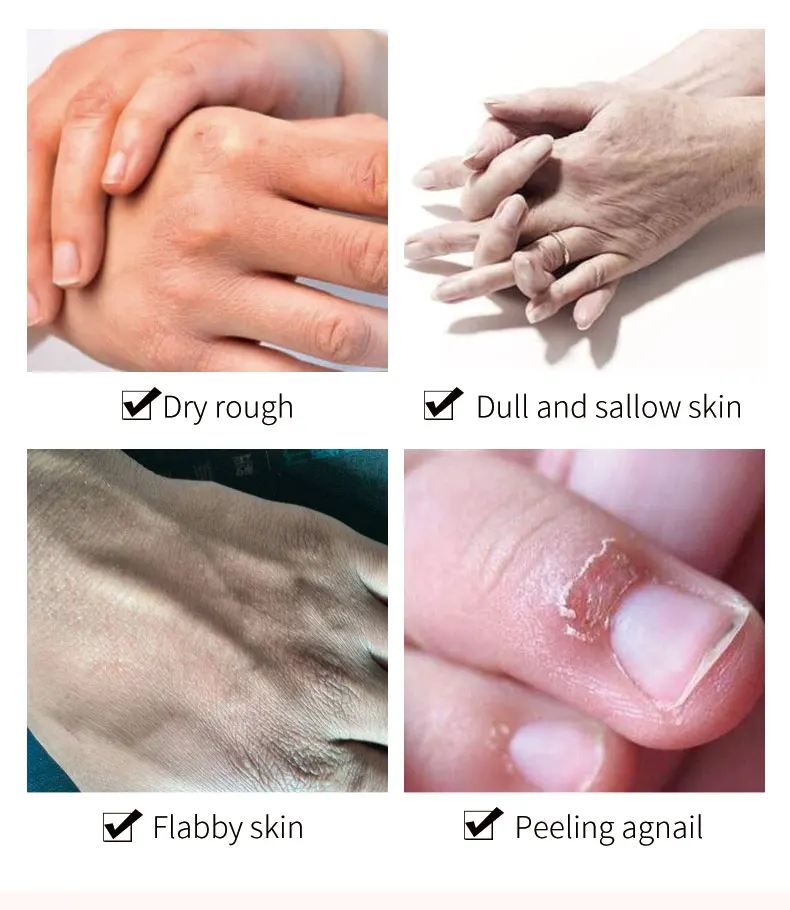 Wholesale Vitamin E Horse Oil Collagen Moisturizing  Hand Cream Aloe Vera Hands & Feet Cream