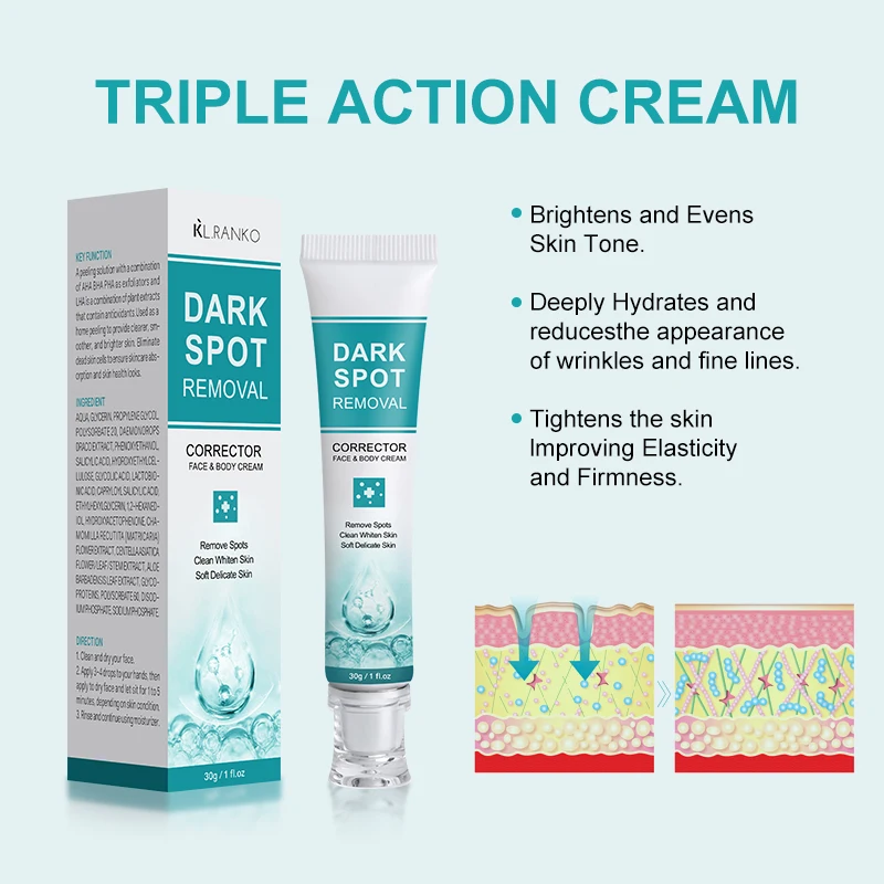OEM Custom Logo Dark Spot Remover Facial Cream Pimples Acne Mark Dark Spots corrector Whitening Face Cream For Skincare Products