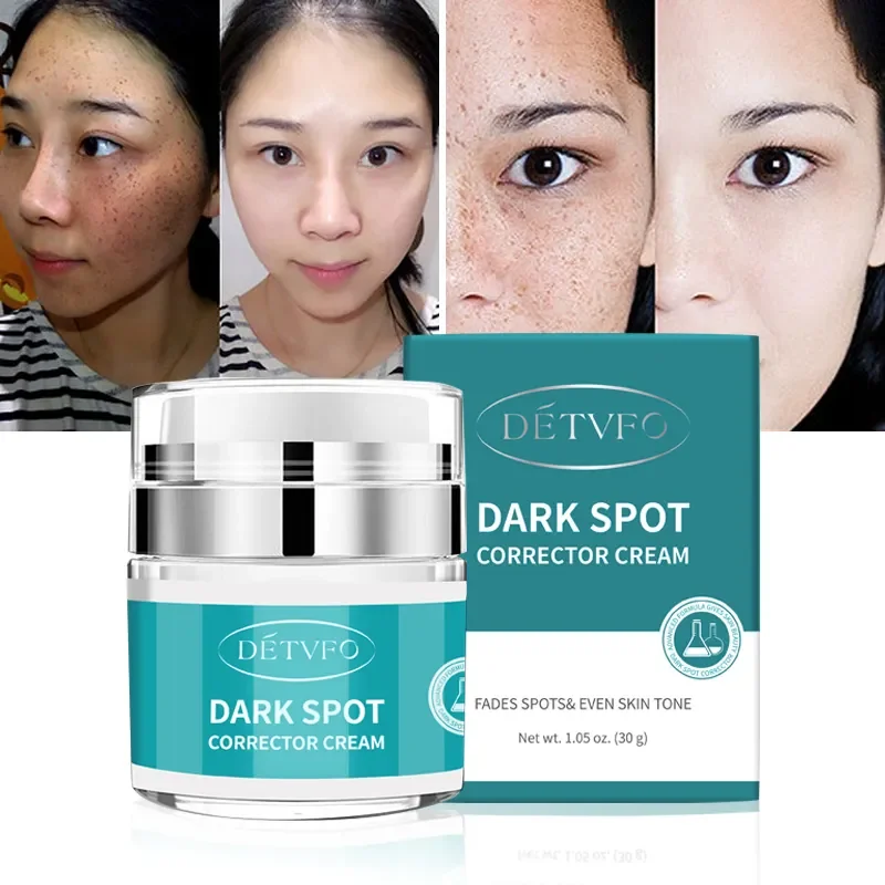 Private Label Repair Face Whitening Freckle Corrector Neck Dark Spot Removal Cream Face Pimples Dark Spot Remover Cream