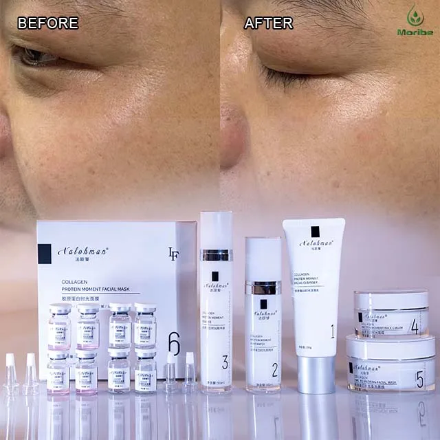 skin care products made in korea  day & night face lotion beauty facial anti acne aging skin care set