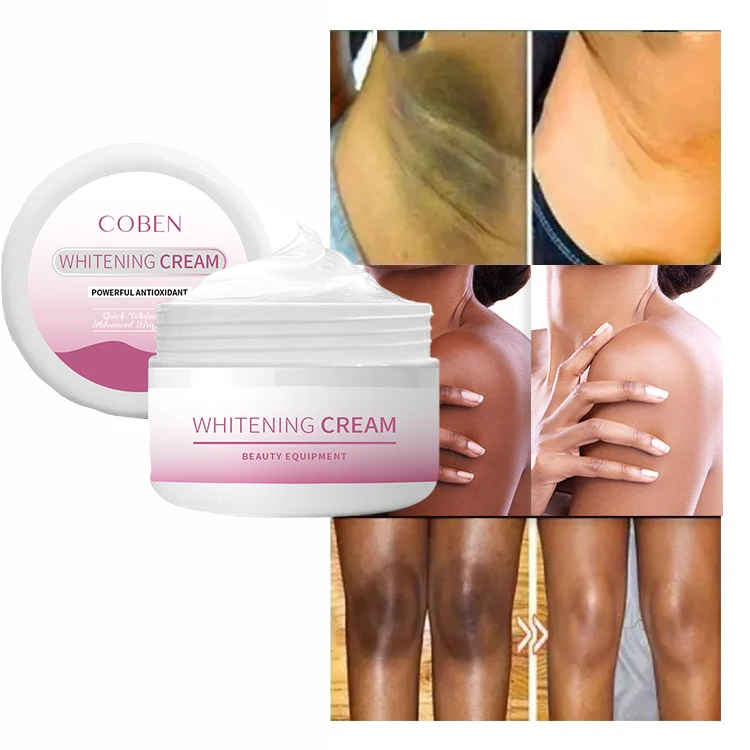 Strong Removal 7 Days Dark Spot Remover Corrector Underarm Legs Knee Elbow Private Parts Brighten Wholesale Skin Whitening Cream