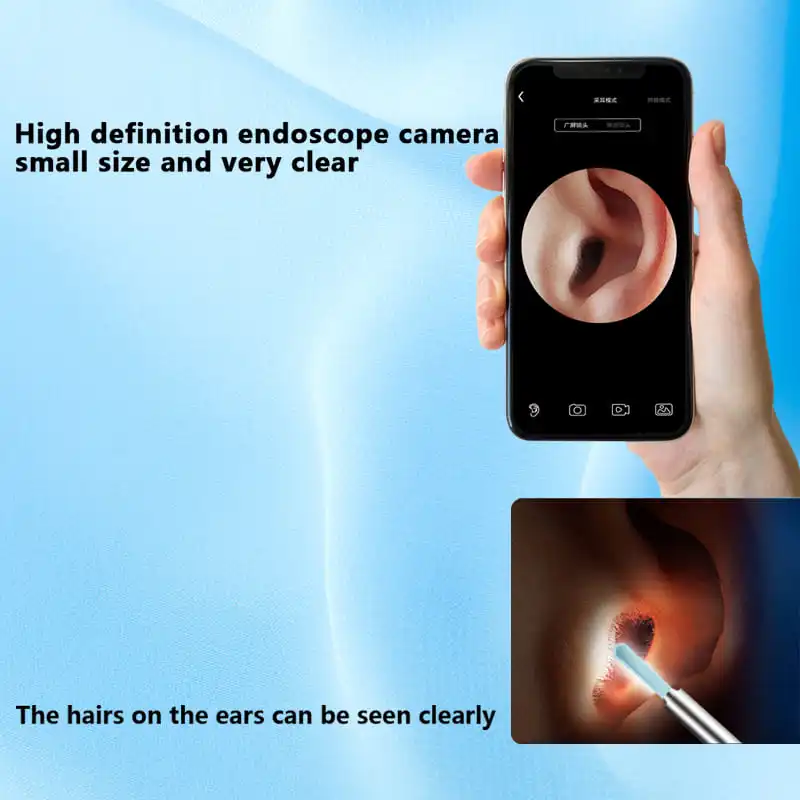 A-smart Visual Ear Cleaning Stick 1000w Hd Pixel Ear Endoscope Ear Wax Removal Tool For Adults And Children